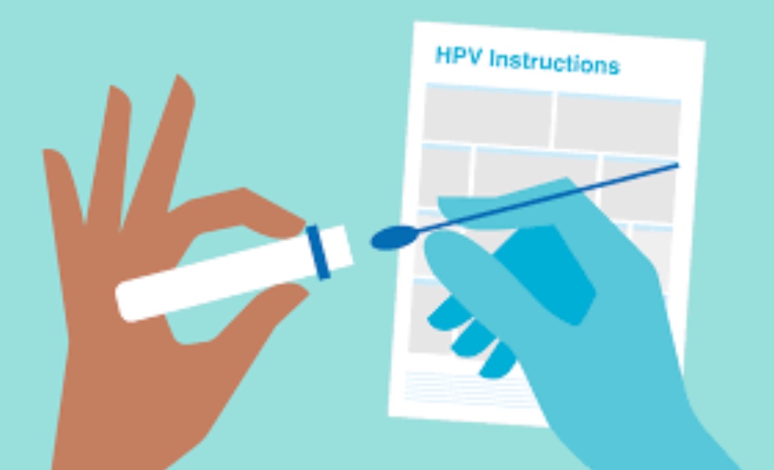 An image of HPV self-sampling kit