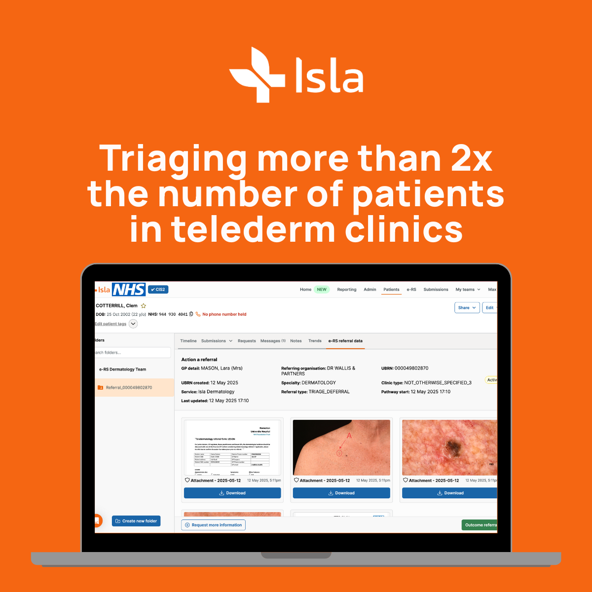 A screen shot of the ISLA digital platform with text above it which says ISLA triaging double the number of patients in telederm clinics.