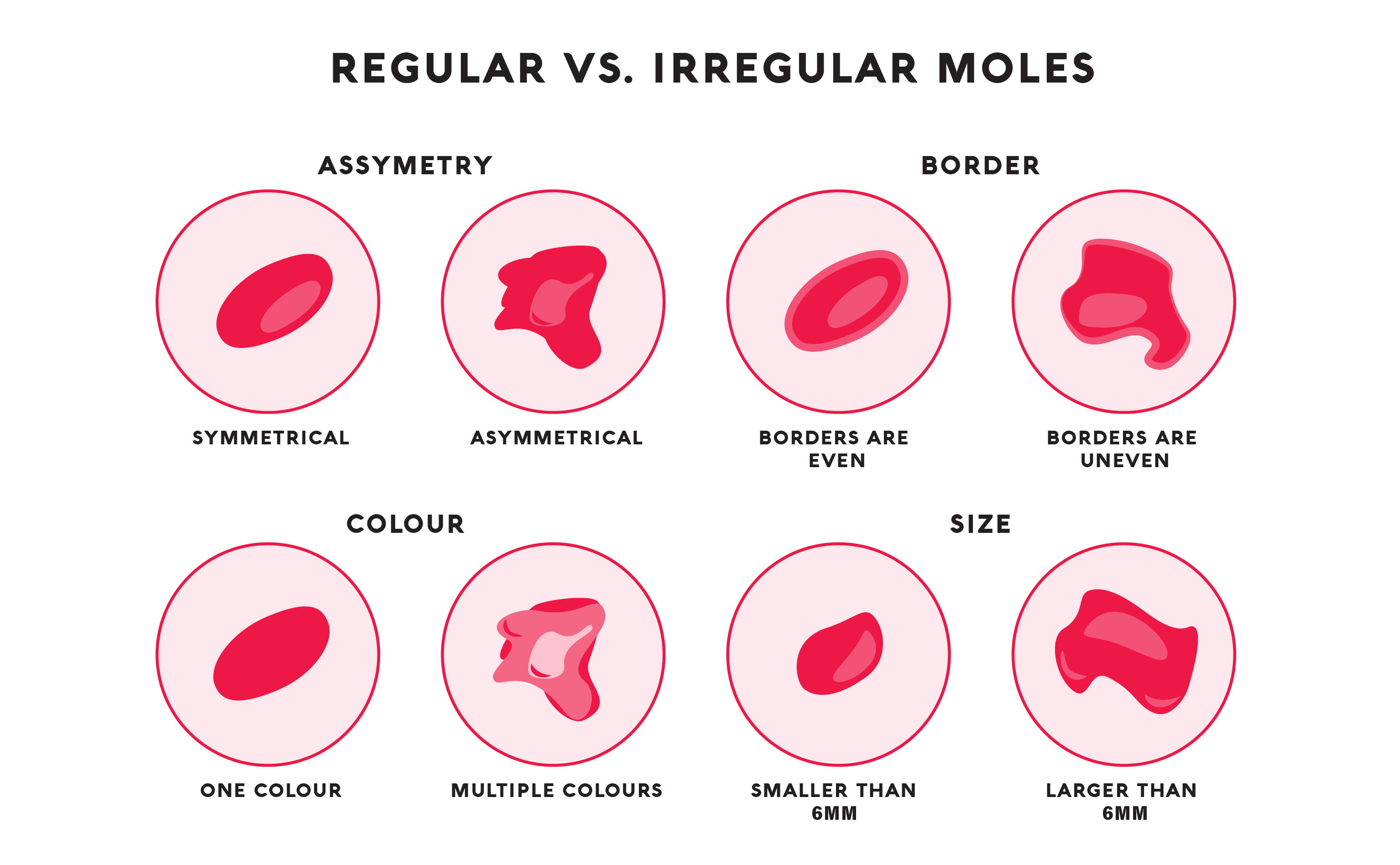 A graphic showing icons of normal moles and irregular moles.