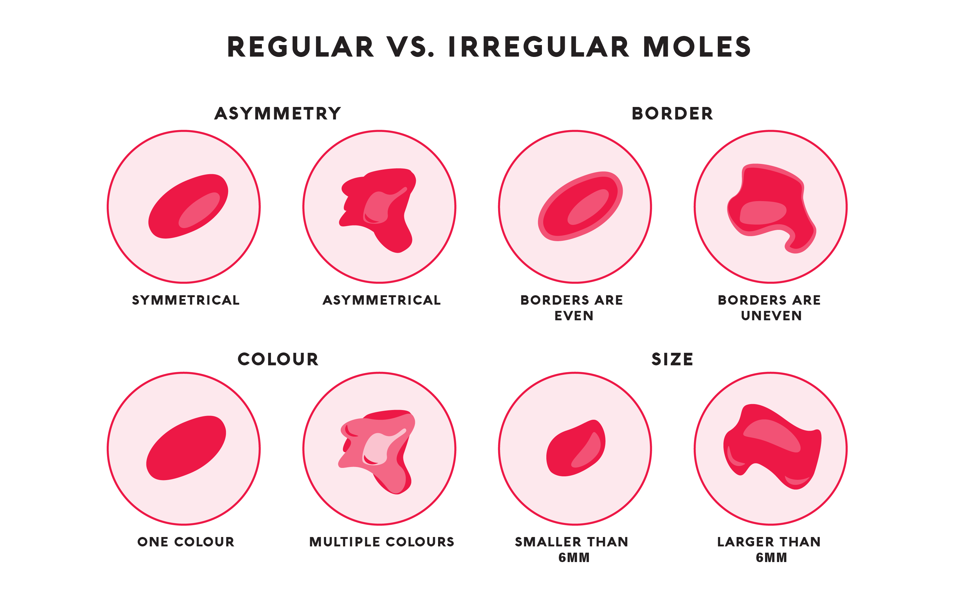 A graphic showing different types of regular and irregular moles.