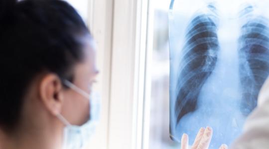 doctor looking at x-ray