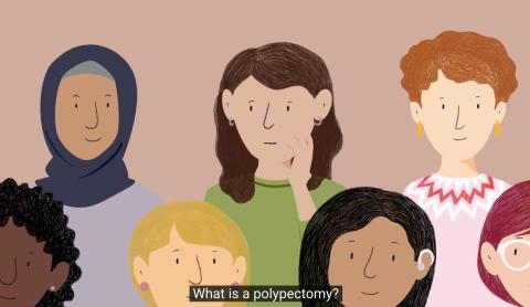 A cartoon graphic of a group of diverse people. A caption below says What is a Polypectomy?