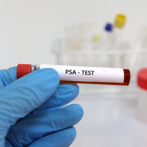 PSA Test kit